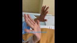 Difference between Unilateral and bilateral asterixis | Animation | Diagnostic sign | Hand Movement