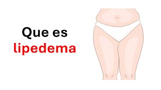 ¿Que es lipedema?