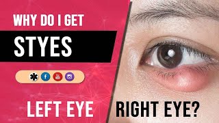 WHY DO STYES COME OUT IN THE EYES? Knobs in LEFT Eye and RIGHT Eye Spiritual Meaning