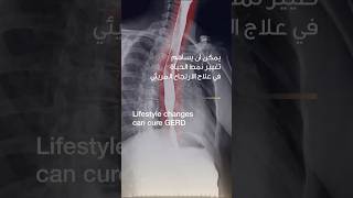 Lifestyle Changes Can Cure GERD | Dr. Louay Roueili | Reem Hospital Abu Dhabi