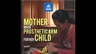 Mother Made a Prosthetic Arm for her Child with Hands On