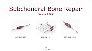 Proximal Tibia Subchondral Bone Repair with CERVOS drill-enabled instruments