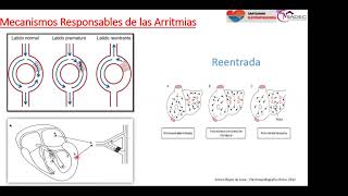 12 - Extrasístoles auriculares y ventriculares