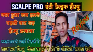 Scalpe pro shampoo review || रुसी  हटाने के लिए साबुन || Rusi Kiase Hatye Balo se