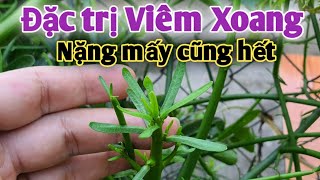 Đặc trị Viêm Xoang nặng mấy cũng hết - Rất hay - PHAN HẢI Vlog