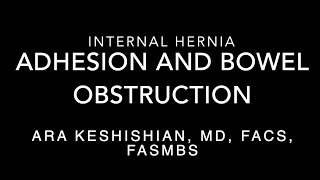 Internal Hernia-Bowel Obstruction