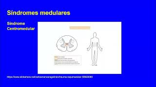 Sd medulares y np Dr Fata