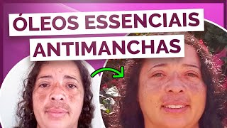 Óleos Essenciais que clareiam manchas e esticam rugas na pele