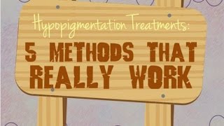 Hypopigmentation Treatments 5 Methods That Really Work