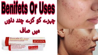 Provate-G cream uses for acne's, scar's, benefits side effects in Urdu|how to use for pimples, face