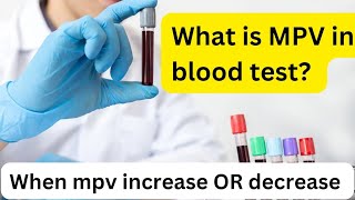 What is Mpv blood test principle procedure Mean Platelet Volume#dmlt #mltclasses