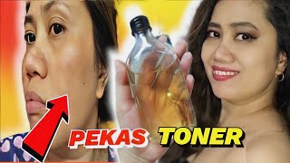 PEKAS CLOVES TONER MELASMA PROBLEM GANITONG TONER ANG GAMIT KO!