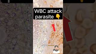 wbc attack to parasite #wbc #dmlt_video #labtech #mltclasses #bacteria #bloodcells 😀1