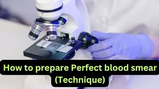 How to prepare Perfect blood smear technique procedure, thick, thin errors #bloodsmear #bloodtest