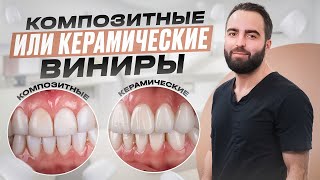 КОМПОЗИТНЫЕ ИЛИ КЕРАМИЧЕСКИЕ ВИНИРЫ?