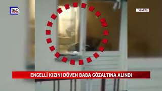 ENGELLİ KIZINI DÖVEN BABA GÖZALTINA ALINDI