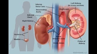 the best solution of   the kidney's stone problem