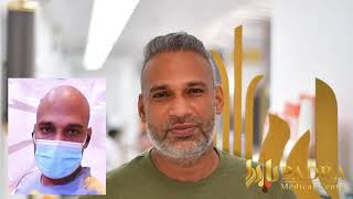 Hair Transplant Result after 7 Month / Padra Medical Center Dubai / Hair Transplant in Dubai