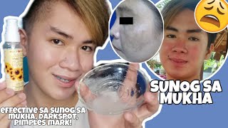 SOLUSYON SA SUNOG SA MUKHA!✨ EFFECTIVE FOR LIGHTENNING DARKSPOT, SUNOG, PIMPLES MARKS!❤️