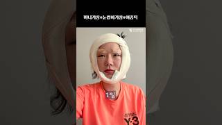 너 갑자기 어려보인다 #plasticsurgeryinkorea