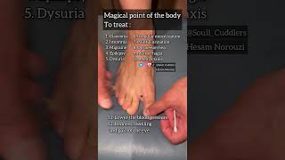 Special acupressure point   #acupuncture #reflexology #acupressure #healing