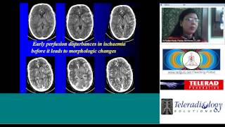 Utility of CTP in stroke - CT perfusion in acute stroke utility & pitfalls by Dr Pradipta Hande