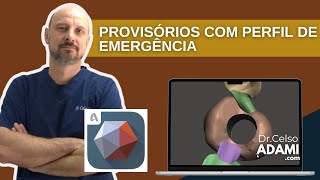 Passo a Passo   Dente Provisório com Perfil de Emergência Ideal no Meshmixer