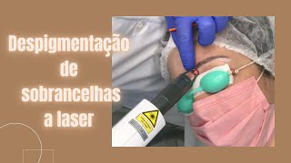 Minha despigmentação de sobrancelhas a laser #leilabittencourt