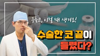 구축코 증상?코끝이 들리고 코가 짧아진다면 모두 구축코일까?