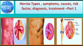 Hernia-Symptoms, causes, types, Risk factor, diagnosis, treatment Part-1