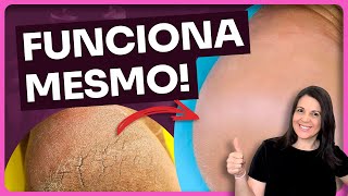 Como tratar pés rachados de forma natural com óleo essenciais