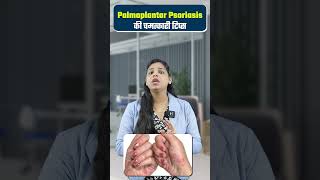 Palmoplantar psoriasis ka ilaj  | पालमोप्लांटर सोरायसिस की चमत्कारी टिप्स #shortsyoutube #shorts