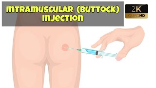 im injection kaise lagate hai short video|ceftriaxone injection for infection|medical knowledge pk