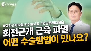 회전근개 근육 파열 시 어떤 수술방법이 있나요?