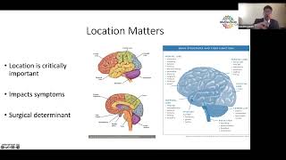 The Glioblastoma Brain Cancer Patient Journey DEMYSTIFIED.