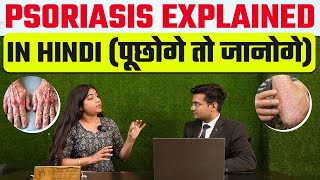 Psoriasis Explained In Hindi - पूछोगे तो जानोगे | Psoriasis in hindi | All about psoriasis