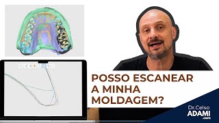 COMPARAÇÃO ENTRE ESCANEAMENTO DE MOLDAGENS, MODELOS, INTRA ORAL E DE BANCADA