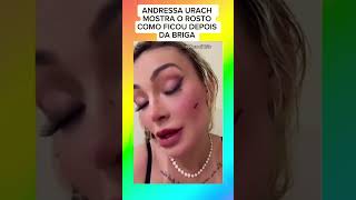 ANDRESSA URACH MOSTRA O ROSTO FERIDO