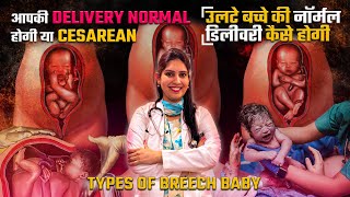 कैसे पता चलेगा डिलीवरी नार्मल होगी कि सिजेरियन ? | Breech Baby Signs | Normal Delivery or cesarean