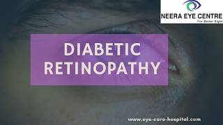 Diabetic Retinopathy | Eye Surgeon | Eye Specialist In Delhi, India