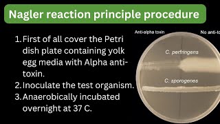 Clostridium perfringens Nagler reaction principle procedure (lecithinase test) #labtech #mltbyrahul