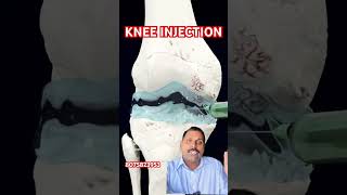 Knee injection