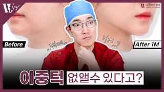 이중턱의 원인을 알아야 확실히 없앨 수 있다! ㅣ 이중턱근육묶기