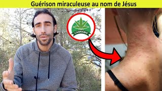 Guérison miraculeuse au nom de Jésus : réaction allergique aux chenilles procéssionnaires