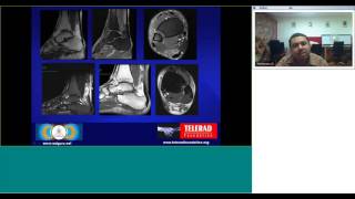 MRI of Ankle by Dr Seetharamu BK