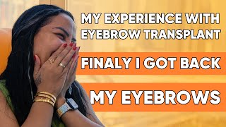 MY EYEBROW TRANSPLANT Experience | Malak