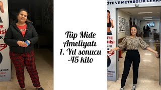 Tüp Mide Ameliyatı 1. yıl Sonucu ✨ Pişmanlıklarım, İyikilerim 💃