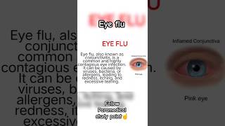 Eye Flu(Conjunctivitis)