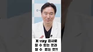 X-ray 검사로알수있는것과알수없는것? #CT #MRI #X-Ray