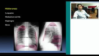 Radiology Teaching on Describing a CXR